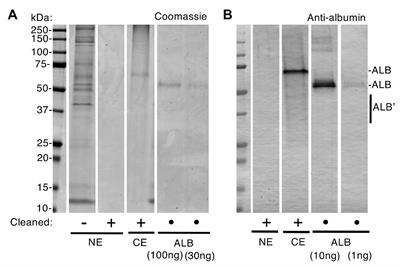 Pathogenesis of Molar Hypomineralisation: Aged Albumin Demarcates Chalky Regions of Hypomineralised Enamel